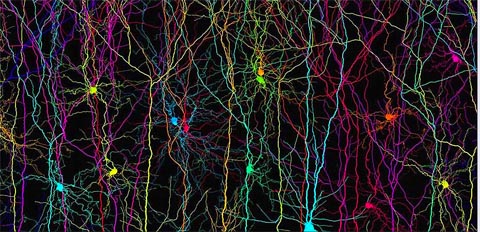 muestra sintética de neuronas piramidales